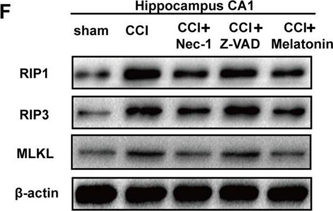 RIPK1/RIP1 Antibody - BSA Free