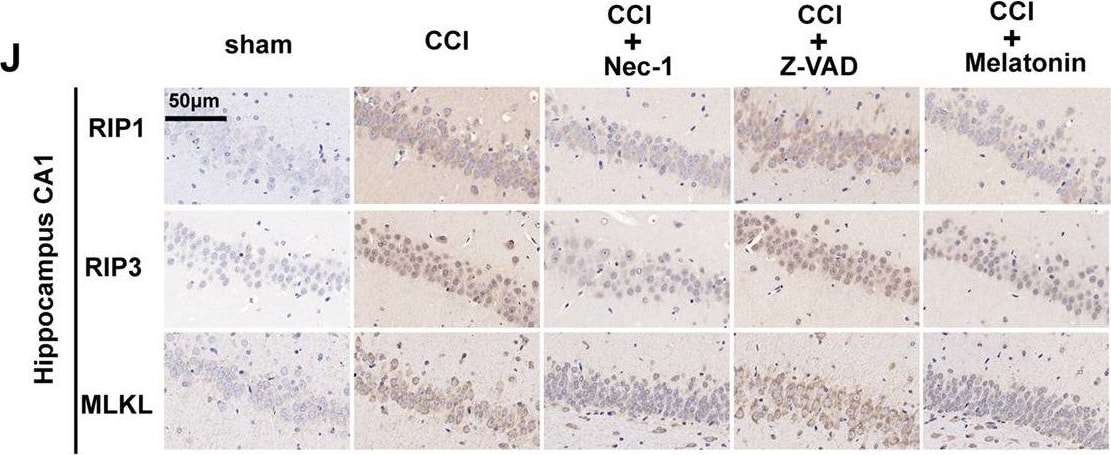 RIPK1/RIP1 Antibody - BSA Free