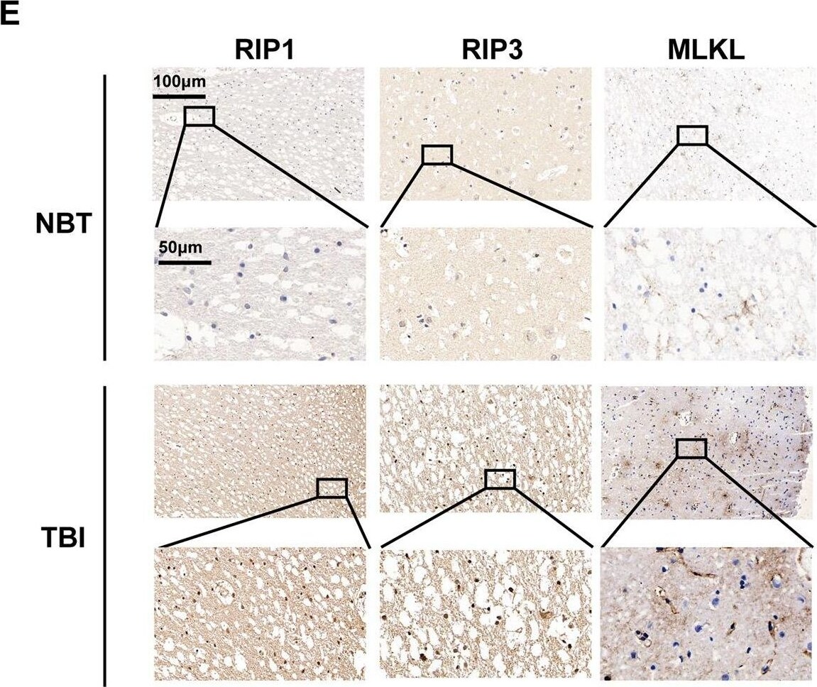 RIPK1/RIP1 Antibody - BSA Free