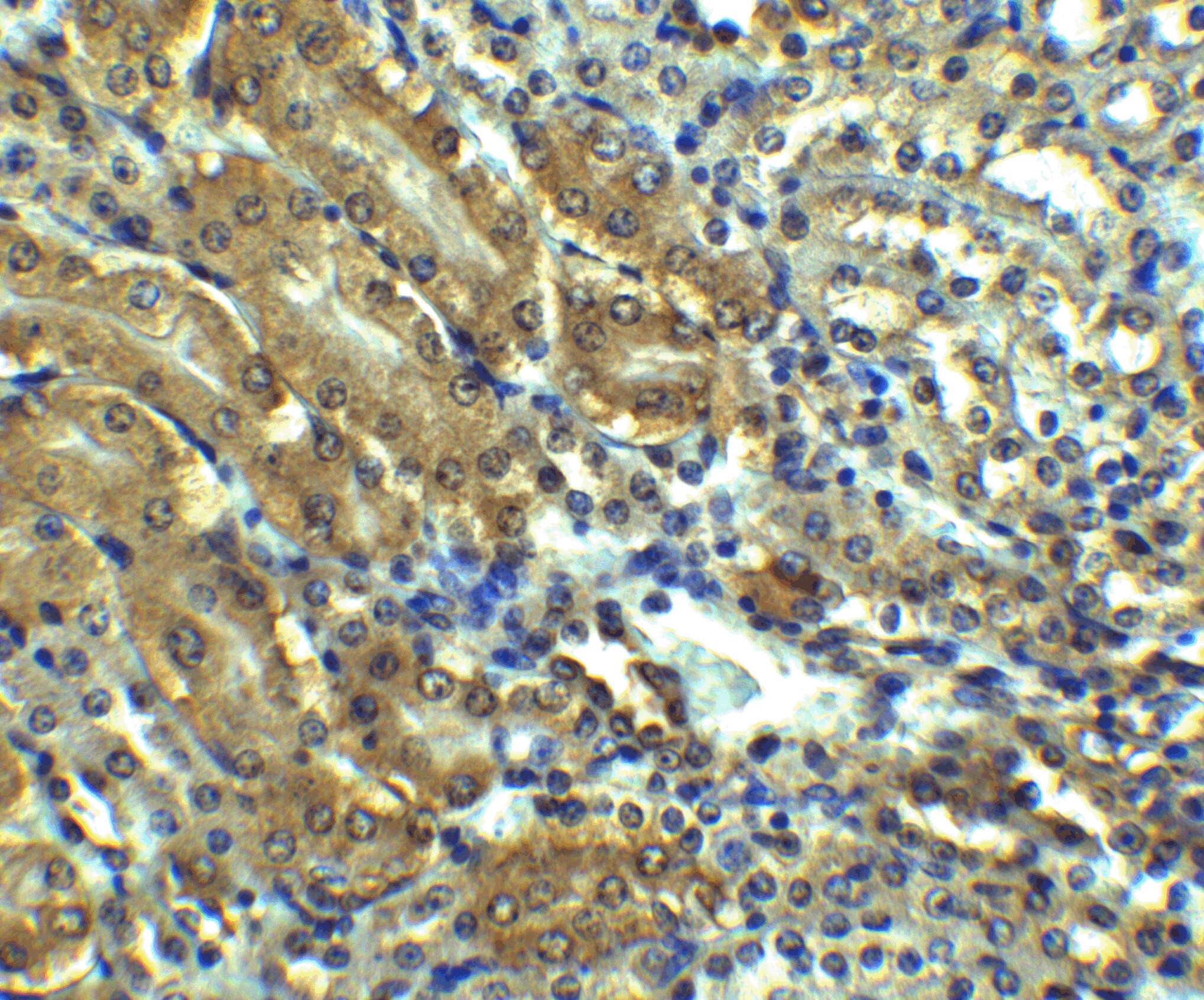 AGTR-1 Antibody - BSA Free