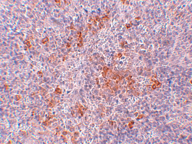 AGTR-1 Antibody - BSA Free