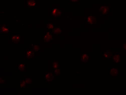 OCIAD2 Antibody - BSA Free