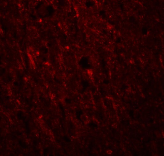 PLEKHM2 Antibody - BSA Free
