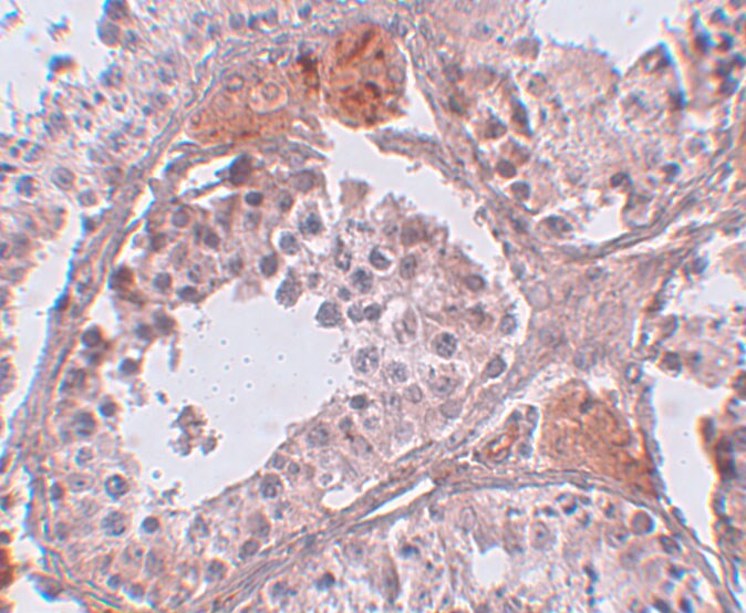 CABS1 Antibody - BSA Free