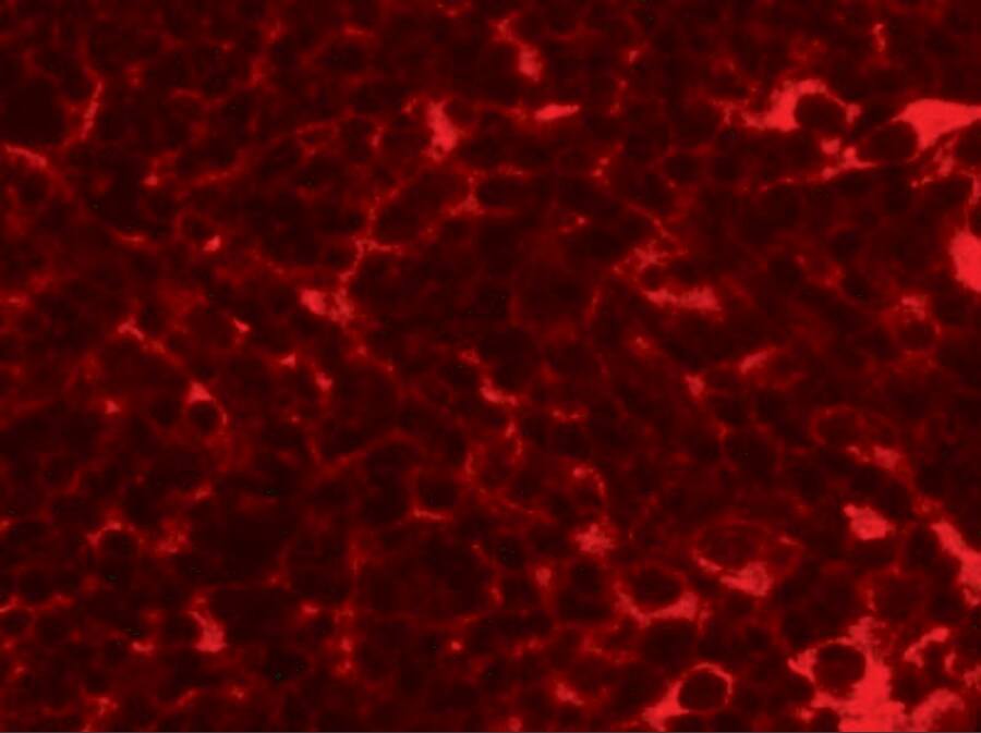 TMEM38B Antibody - BSA Free