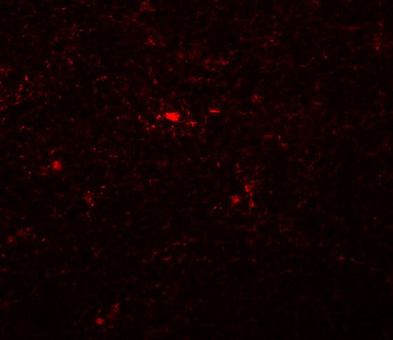 NAT11 Antibody - BSA Free
