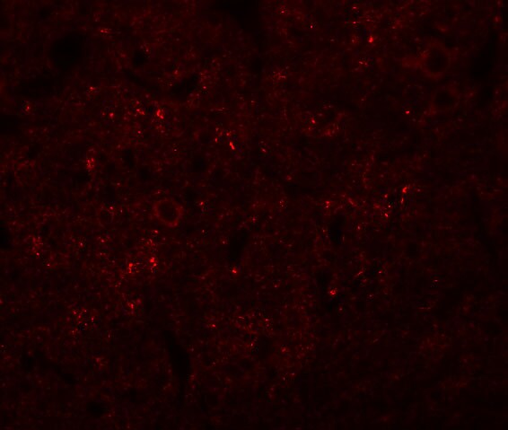Synaptogyrin 3 Antibody - BSA Free