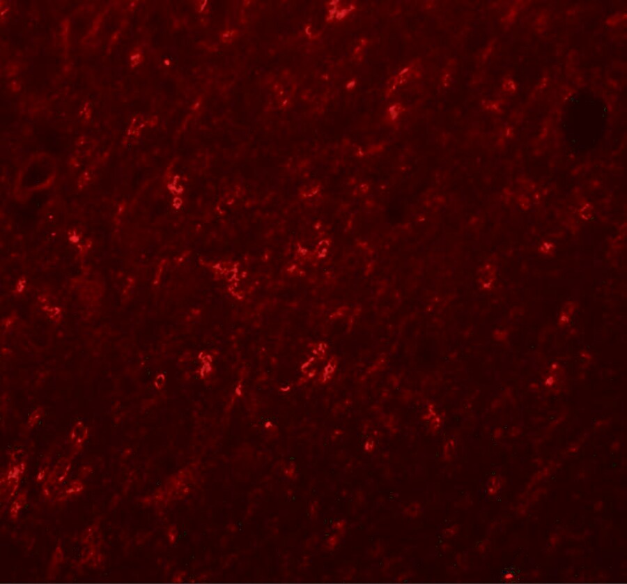 Synaptogyrin 4 Antibody - BSA Free