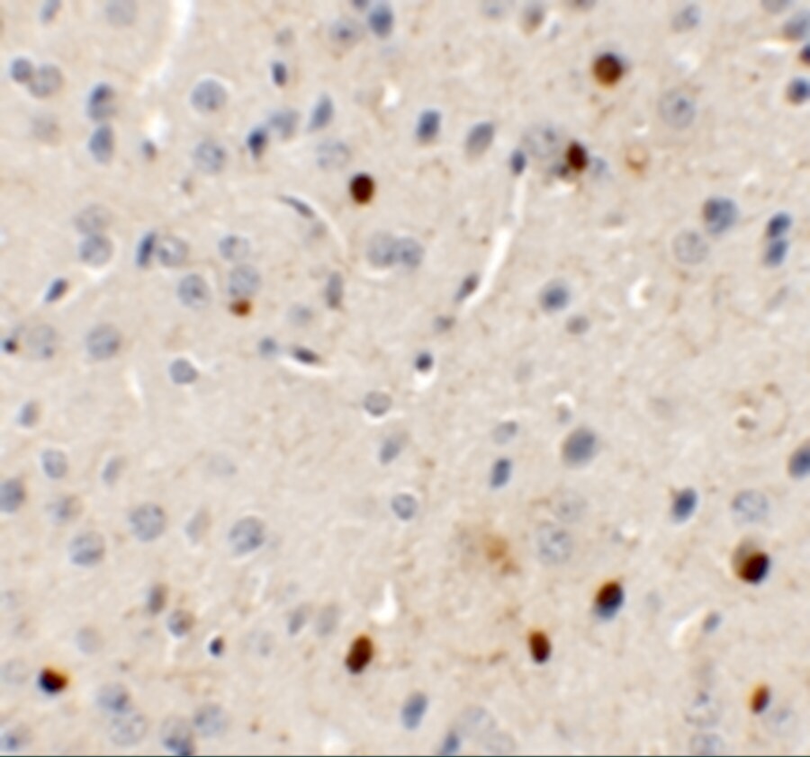 SPRYD3 Antibody - BSA Free