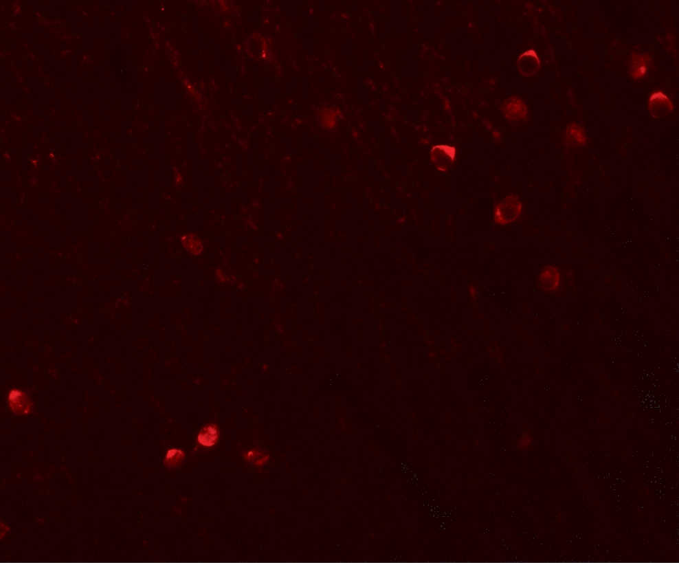 SPRYD3 Antibody - BSA Free