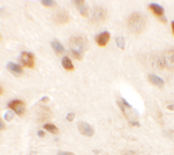 CMYA5 Antibody - BSA Free