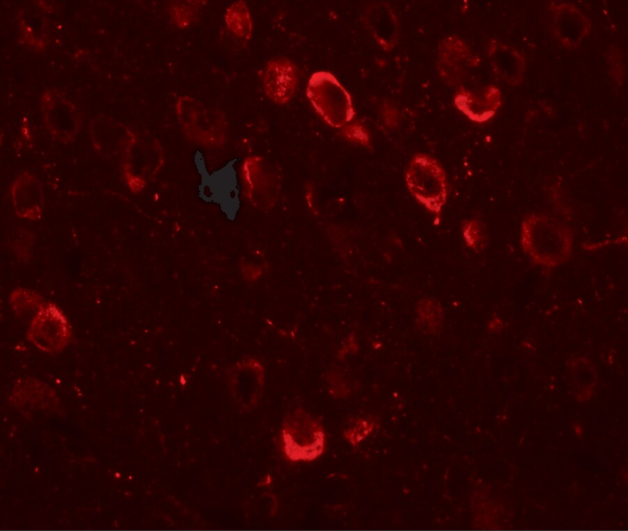CMYA5 Antibody - BSA Free