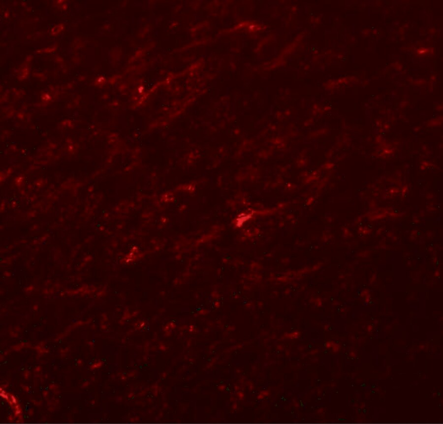 TCF-3/E2A Antibody - BSA Free