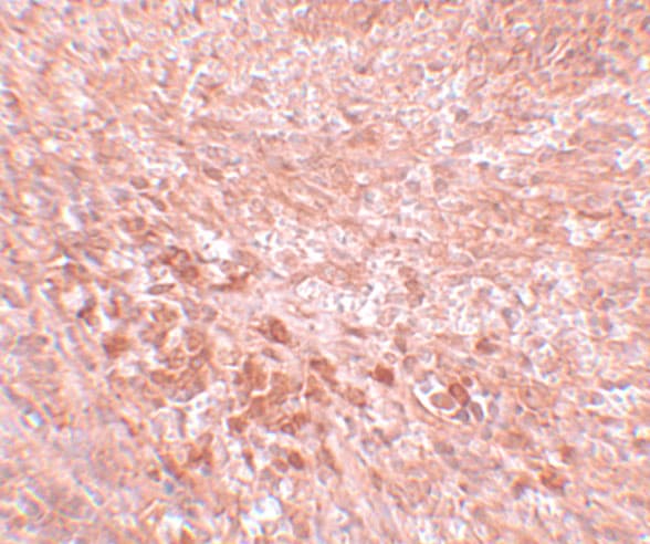 LZTR2 Antibody - BSA Free