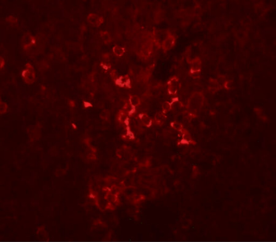 LZTR2 Antibody - BSA Free