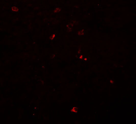 Breast carcinoma amplified sequence 3 Antibody - BSA Free