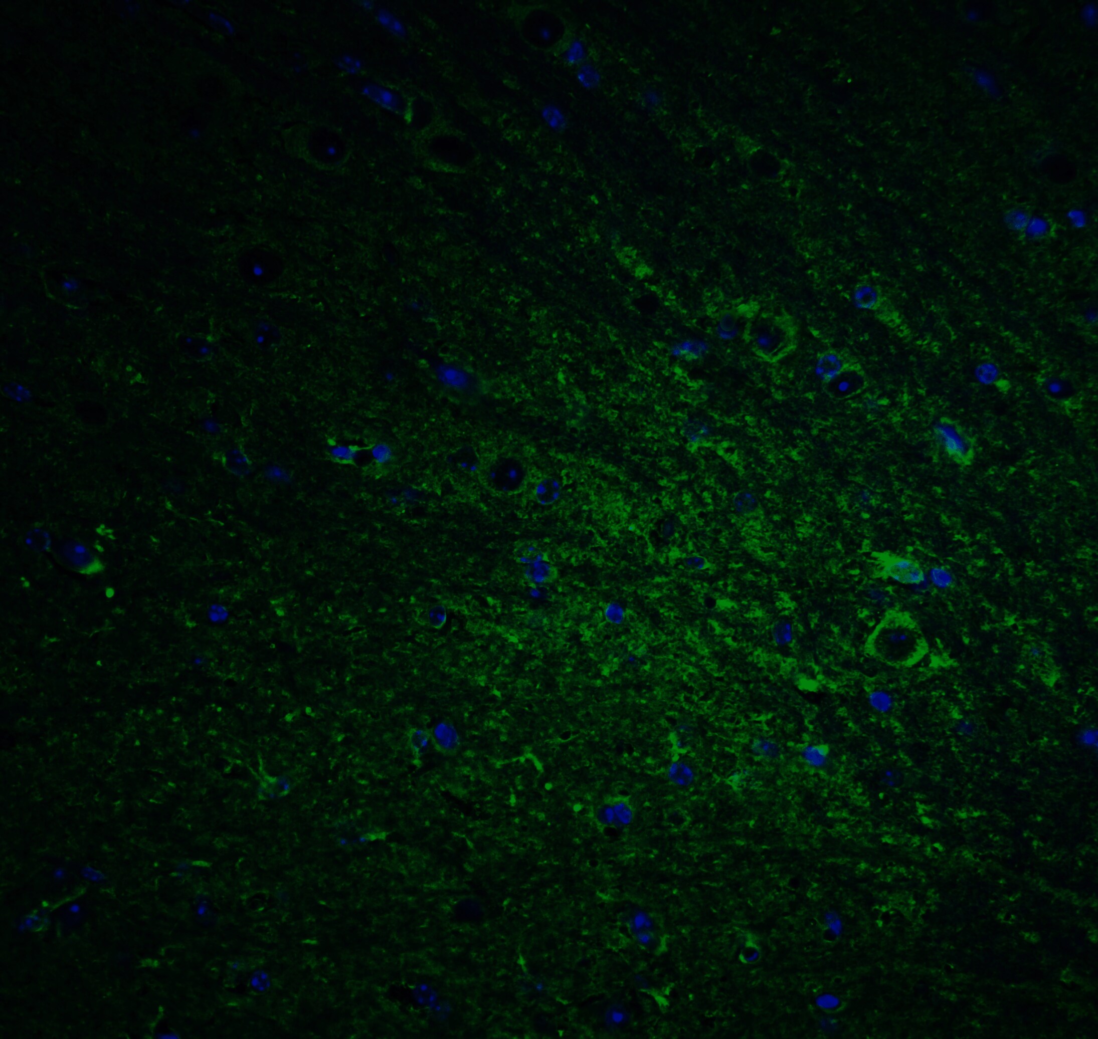DCLK1 Antibody - BSA Free