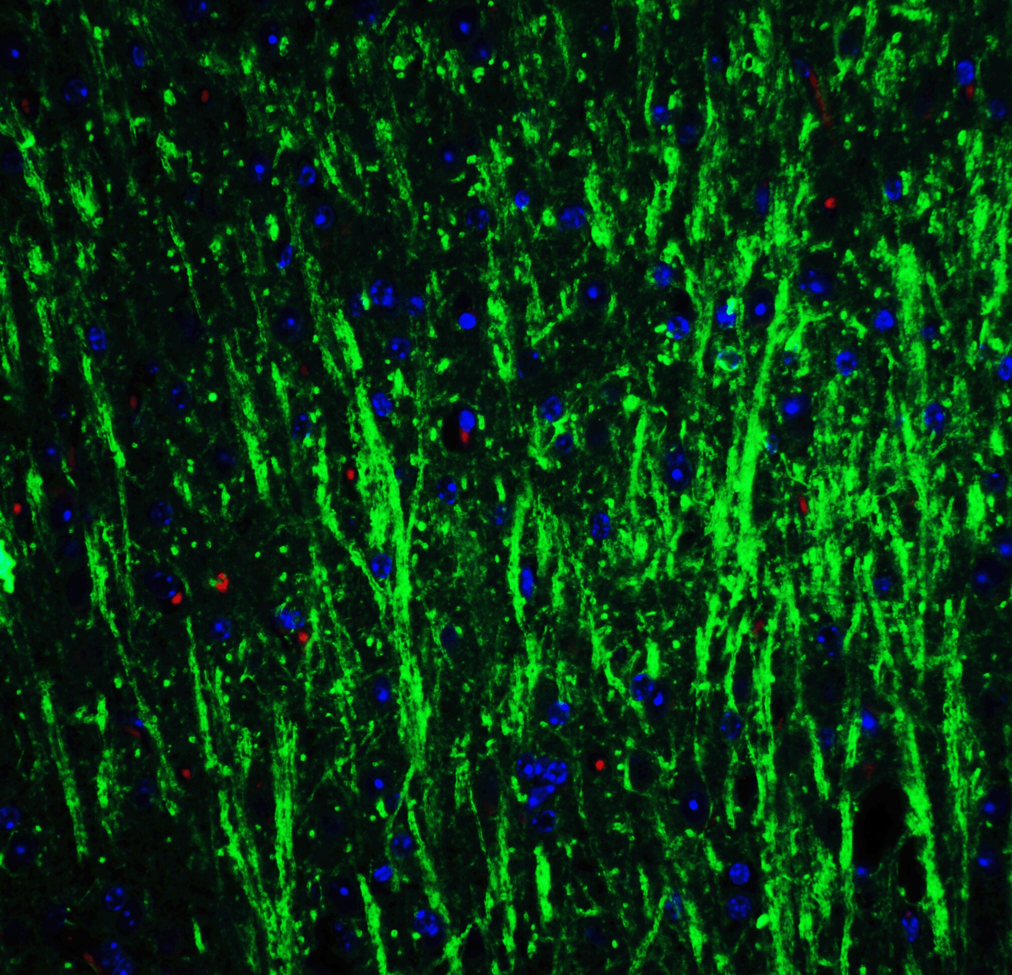 DCLK3 Antibody - BSA Free