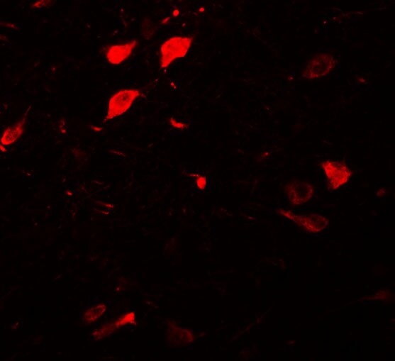 DCLK3 Antibody - BSA Free
