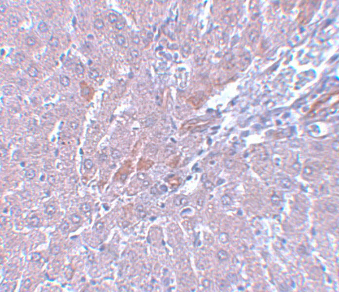 LYRM1 Antibody - BSA Free