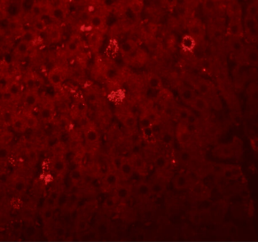 LYRM1 Antibody - BSA Free