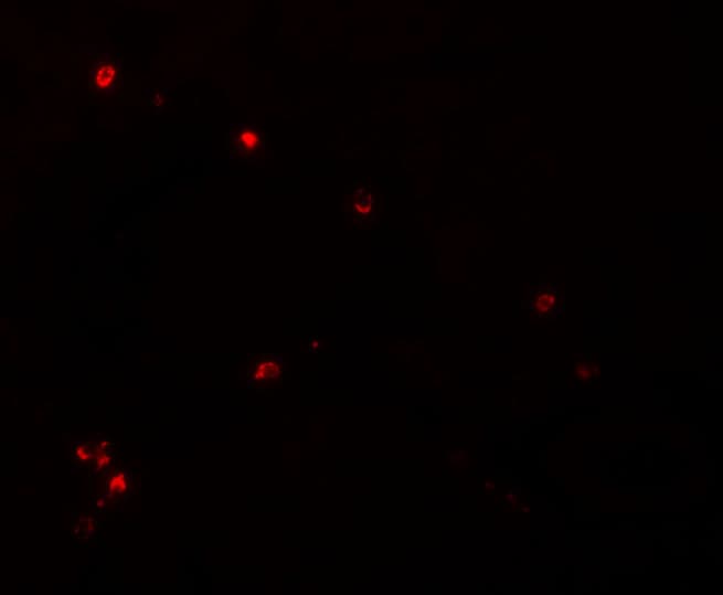 NDUFB9 Antibody - BSA Free