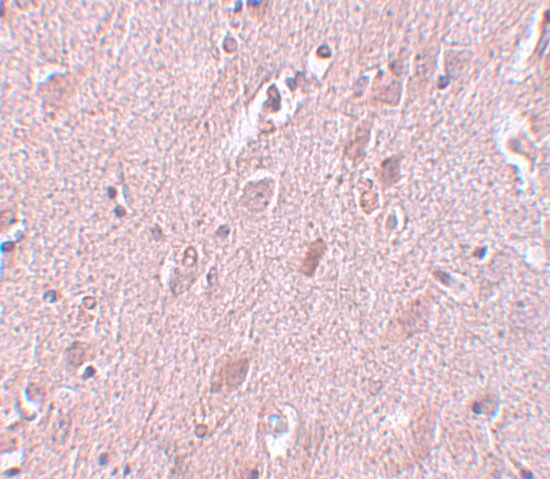 ZC3H12B Antibody - BSA Free