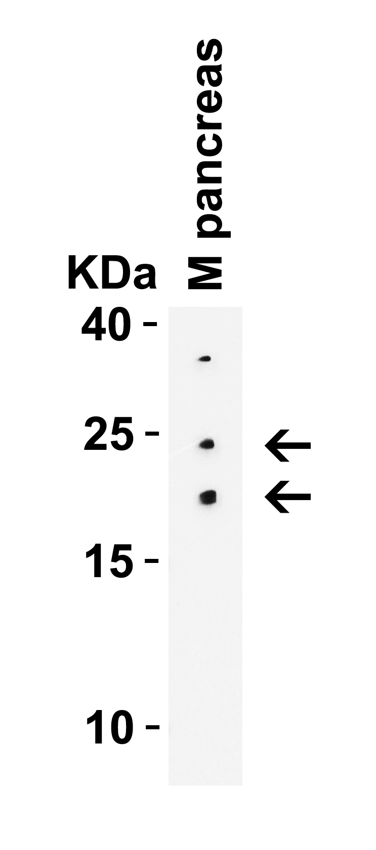 CCDC69 Antibody - BSA Free