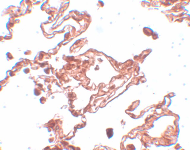 CCDC69 Antibody - BSA Free