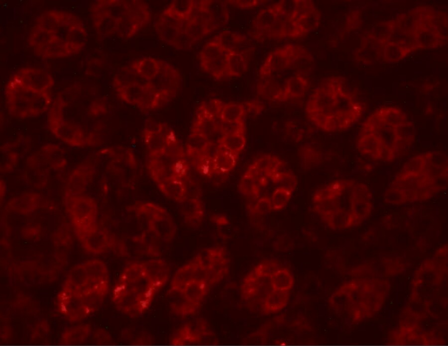 ENC1 Antibody - BSA Free