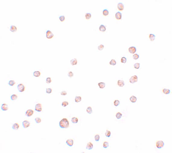 KLHL25 Antibody - BSA Free