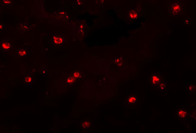 KLHL25 Antibody - BSA Free