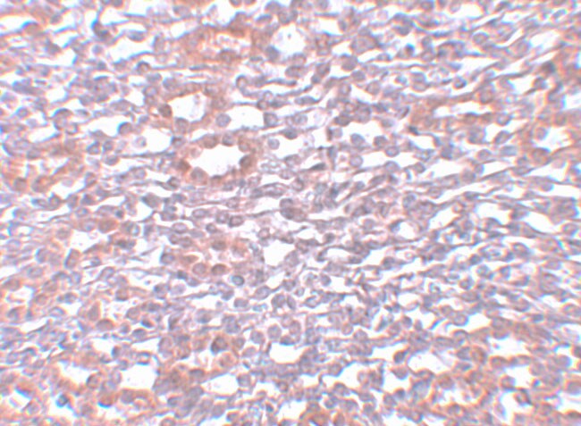 PIAS1 Antibody - BSA Free