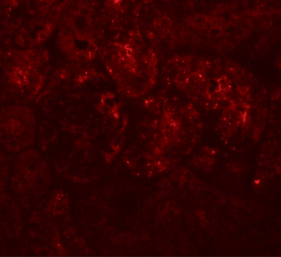 PIAS1 Antibody - BSA Free