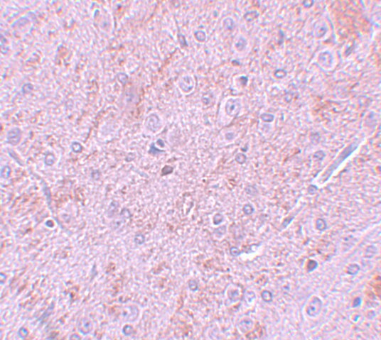 PIAS2 Antibody - BSA Free