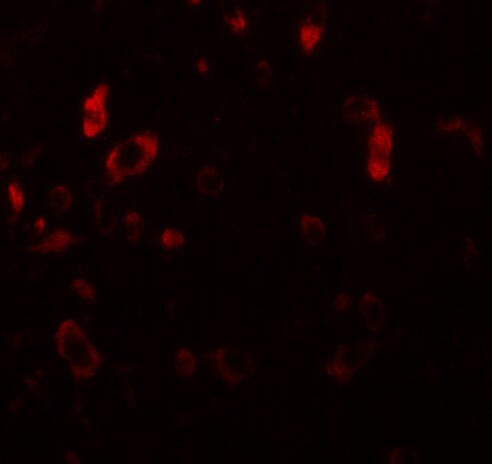 PIAS2 Antibody - BSA Free
