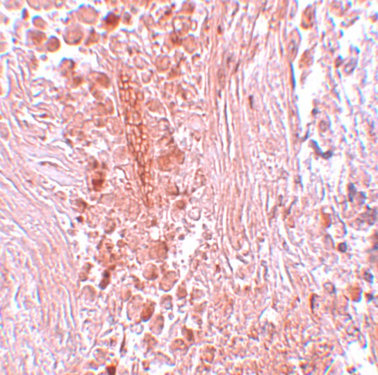 PIAS3 Antibody - BSA Free