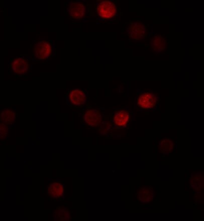 GEMIN2 Antibody - BSA Free