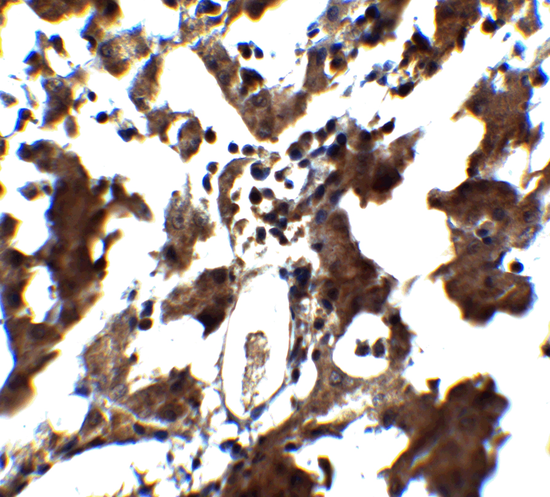 ZEB1 Antibody - BSA Free