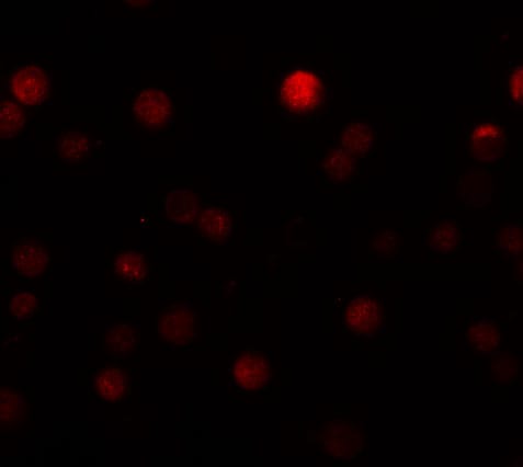 ZEB1 Antibody - BSA Free