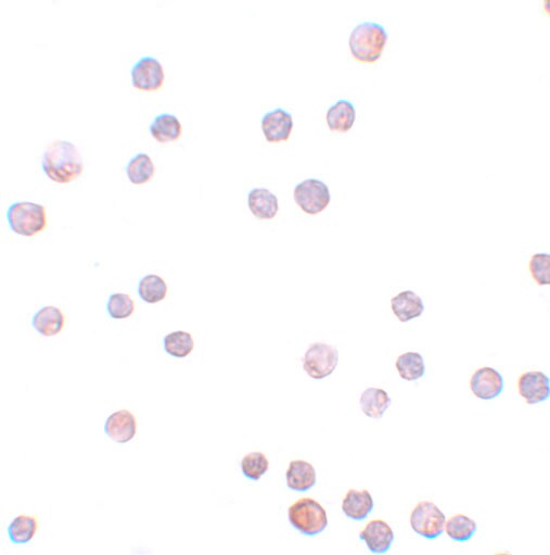ZEB1 Antibody - BSA Free