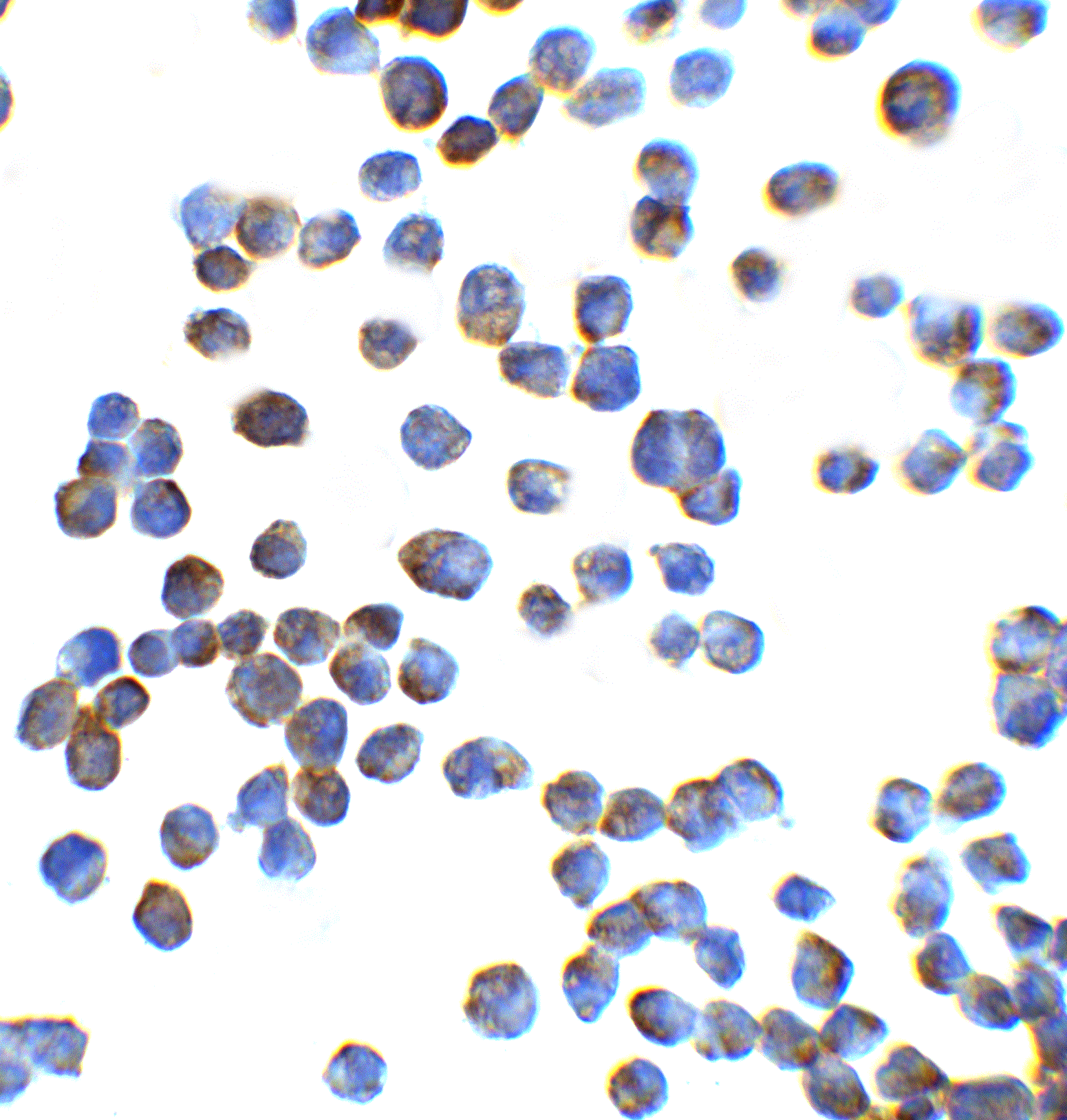 ZEB1 Antibody - BSA Free