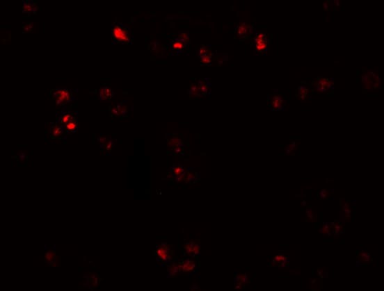 ZEB2 Antibody - BSA Free
