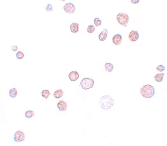 QBRICK/FREM1 Antibody - BSA Free