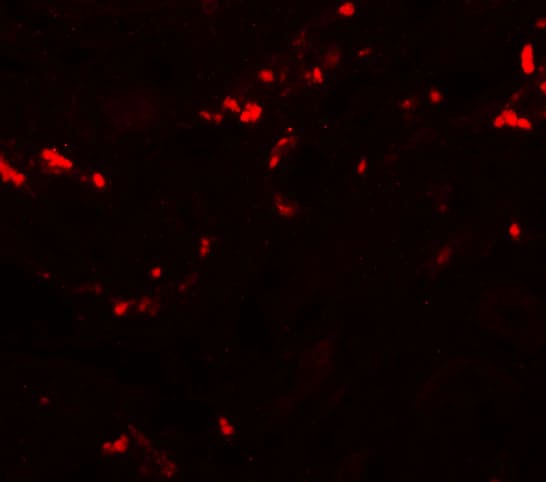 TCTN1 Antibody - BSA Free