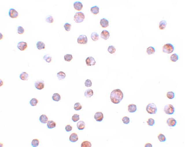 ZCCHV Antibody - BSA Free