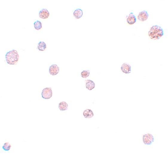 ATP11A Antibody - BSA Free