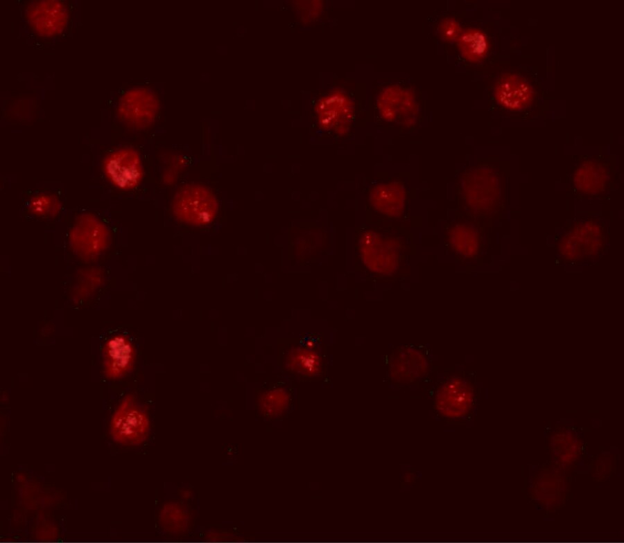 ATP11A Antibody - BSA Free