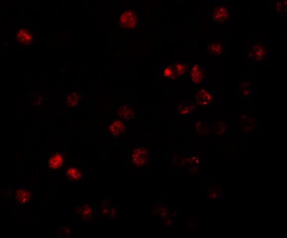 ATP11B Antibody - BSA Free