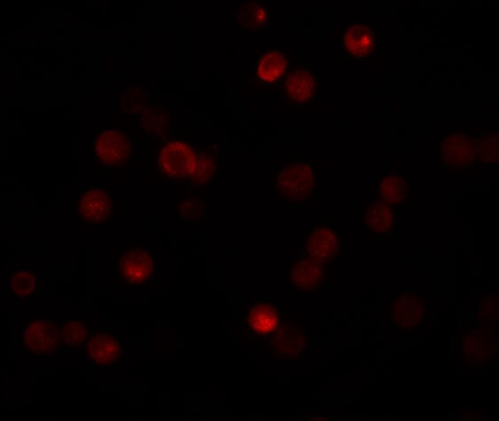 CABP7 Antibody - BSA Free